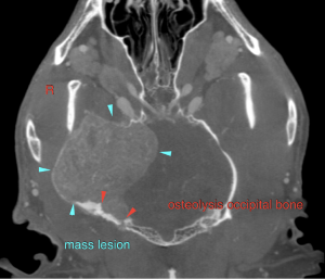 March 2018 Sonopath Case Of The Month: Agressive Brain Lesion in a 4-Year-Old FS Mixed Breed Canine