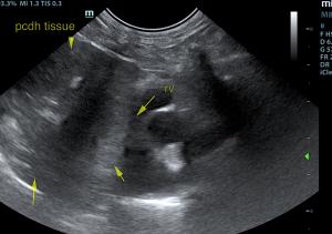 Pericardial Diaphragmatic Hernia in a 2-year-old FS DLH cat: Our Case Of the Month January 2019