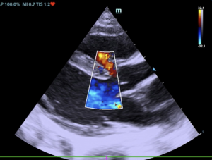 VSD in an 8-Month-Old DSH Cat; SDEP™ ECHO Attendee SonoPodcast