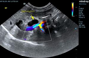 Post-Hepatic Obstruction With Chronic Cholangitis In A 12-Year-Old FS Poodle Mix: Our Case Of the Month 2019