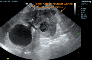 A² + B² = C² “The Telemed Sonogram Theorem”: Our Case Of the Month Nov. 2019