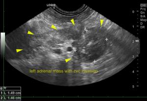 Left Adrenal Mass in an 8-year-old MN Chihuahua Mix: Our Case Of the Month March 2020