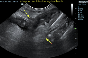 Inguinal Hernia in an 8-Year-Old MN Yorkshire Terrier: Our Case Of the Month: May 2020